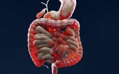 Anti-Inflammatory Drugs for Crohn’s Disease