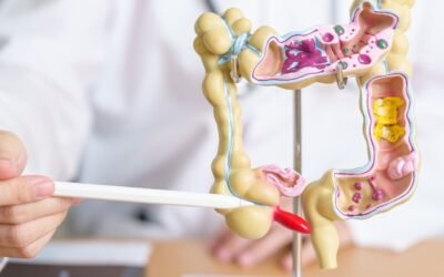 When Should You Start Colon Cancer Screenings? A Lifesaving Timeline