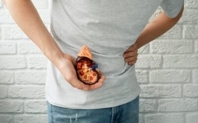 How to Tell if You Have Kidney Stones: What to Know