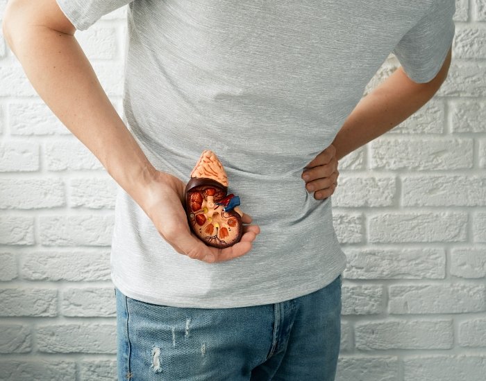 kidney stone symptoms