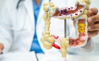 Signs and Symptoms of Appendix Bursting: Key Facts