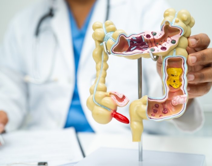 appendicitis symptoms