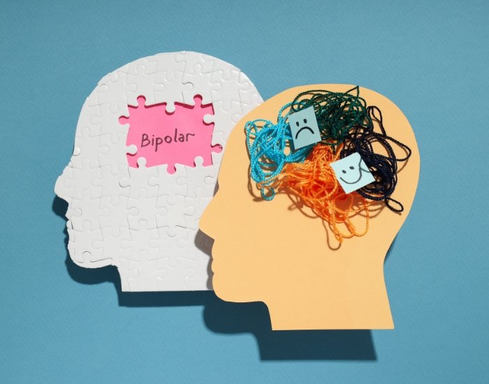 depressive episodes in bipolar